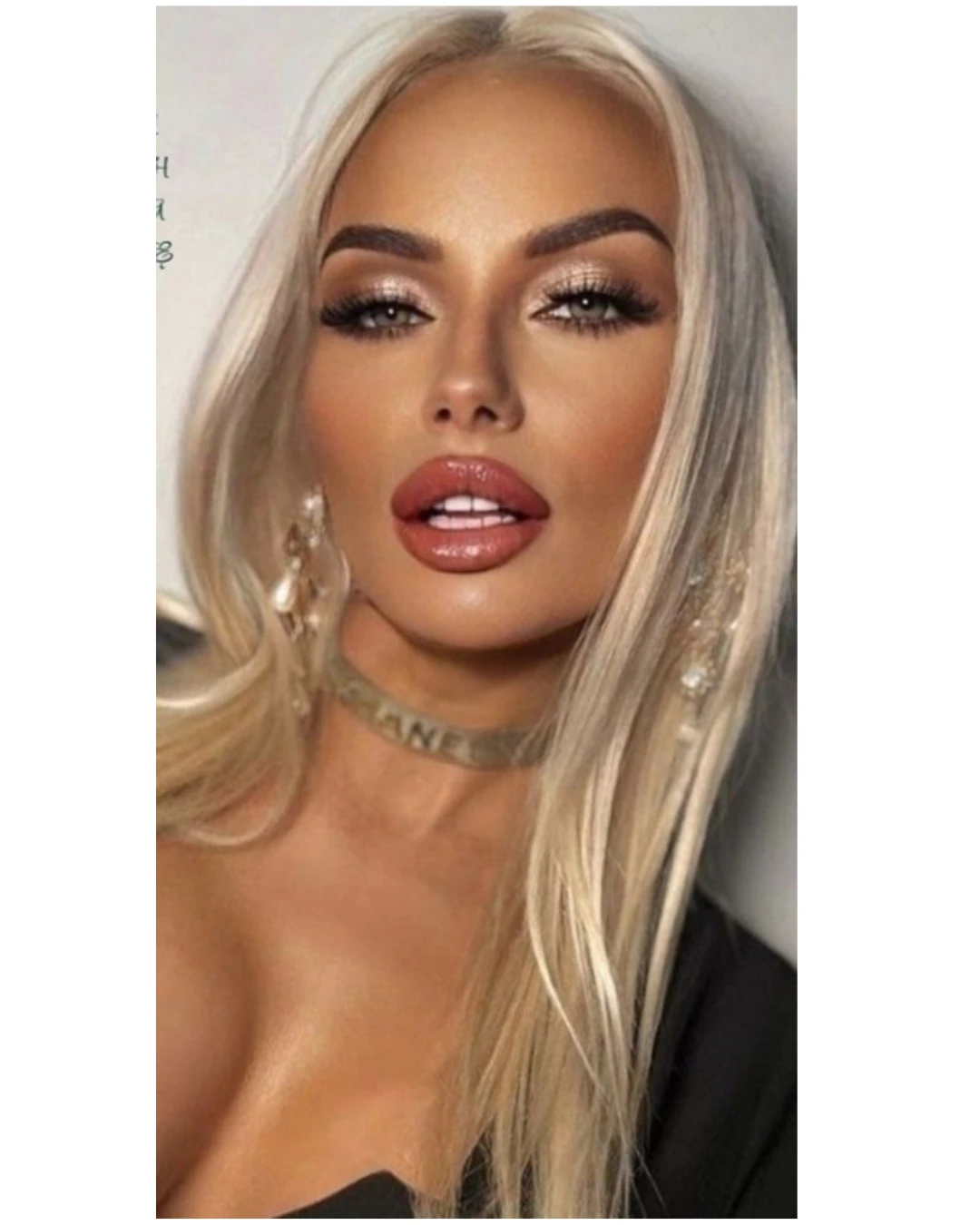 Body masculinization in Tijuana - masculine chest contouring with Dr. Alfredo Chama